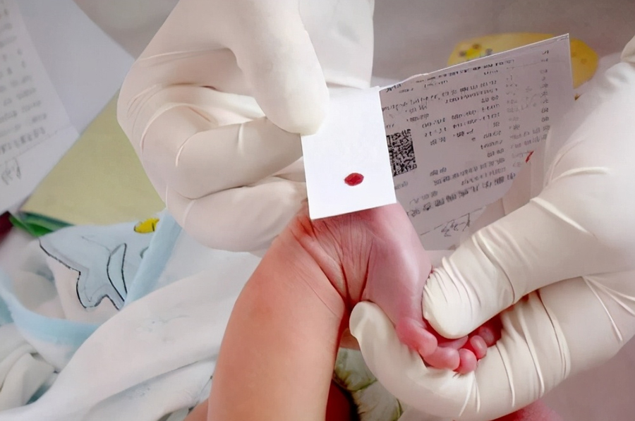 徐州医院办理血缘检测哪里做的准,医院做血缘检测样品有哪几种